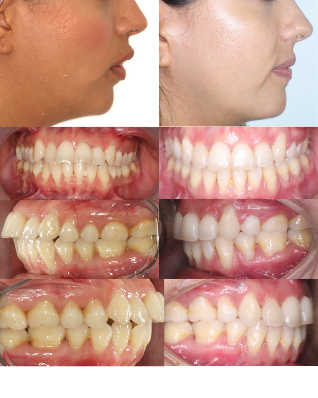 Transformación dental 11