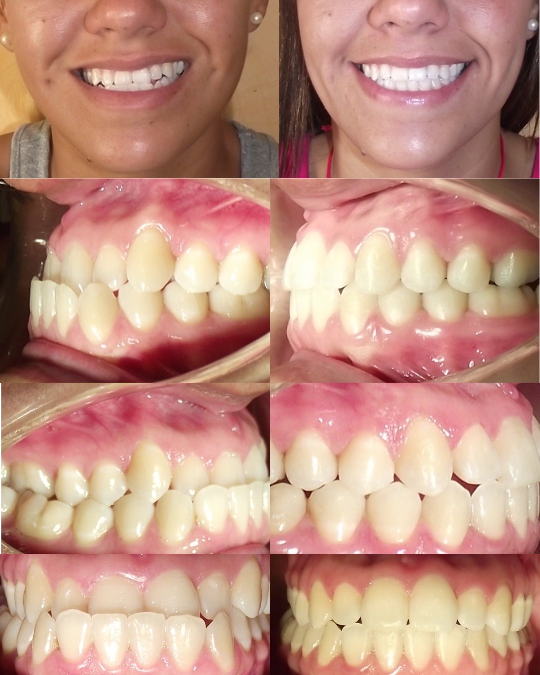 Transformación dental 3