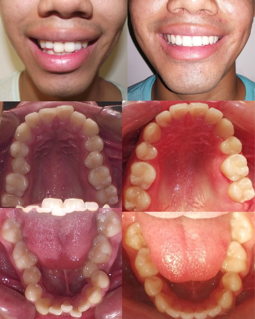 Transformación dental 5