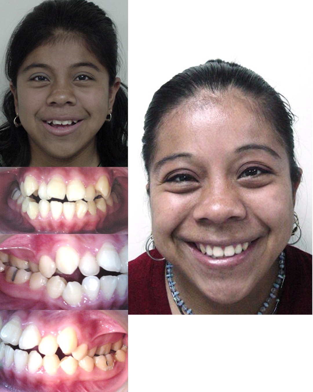 Transformación dental 6