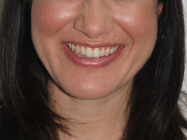 Después - Margarita