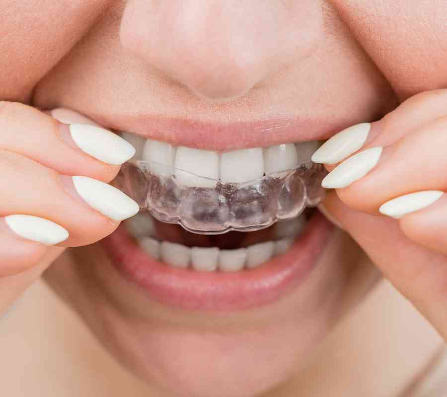 Tratamiento Invisalign